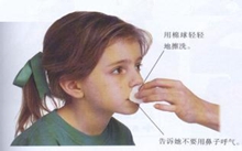 鼻子出血怎么办